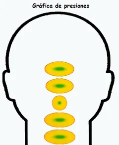 Gráfica de puntos de presión en la cabeza